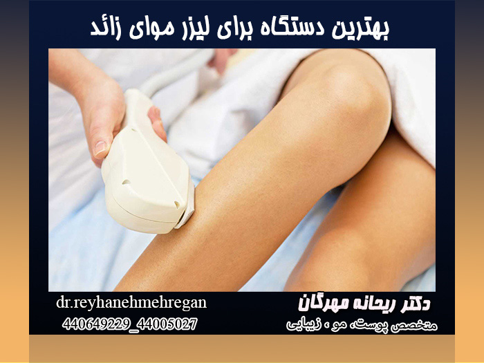 بهترین دستگاه برای لیزر موای زائد