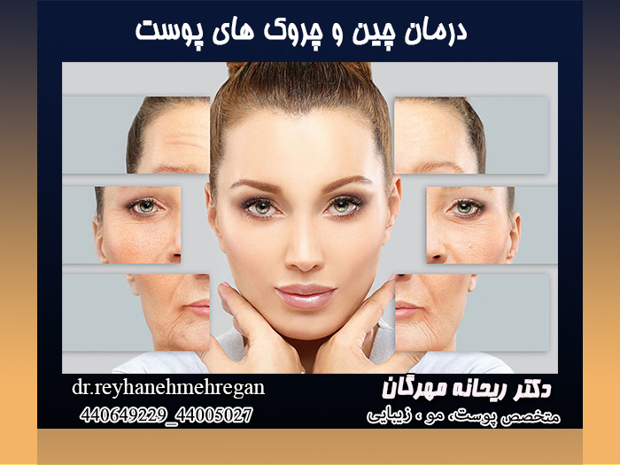 درمان چین و چروک های پوست
