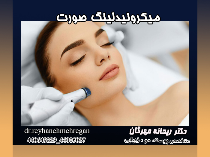 میکرونیدلینگ صورت
