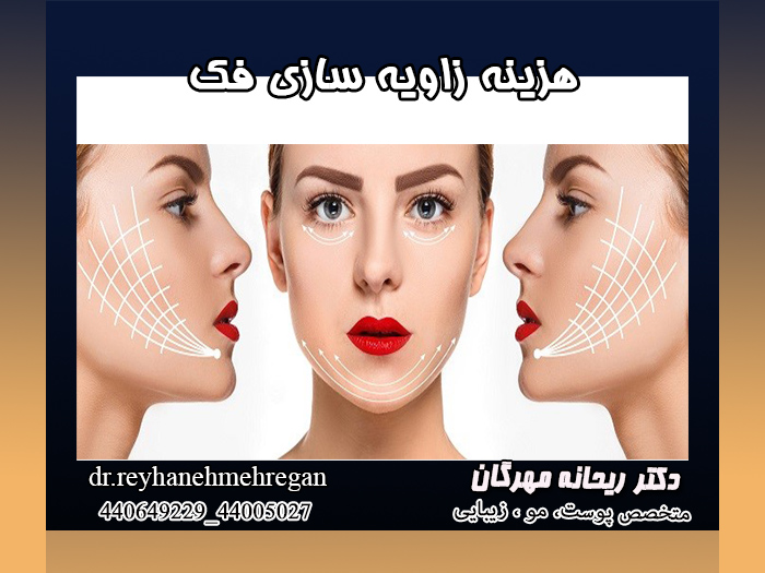 هزینه زاویه سازی فک