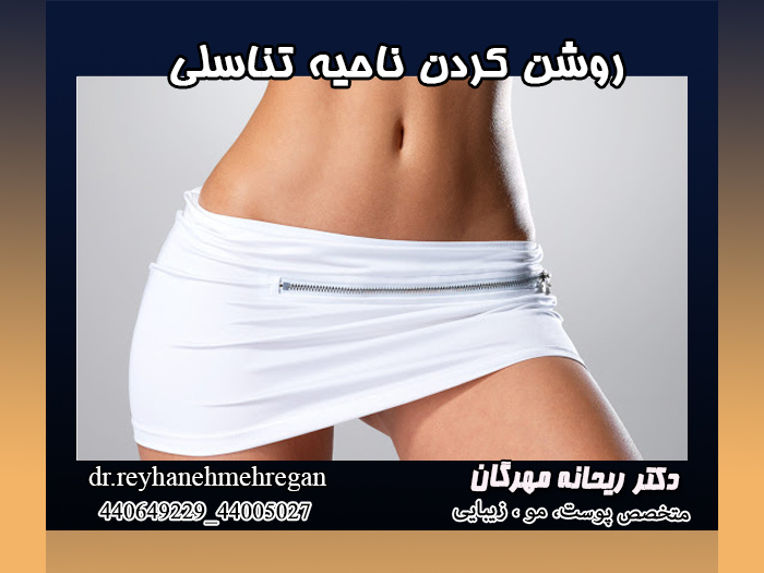 روش های درمان تیرگی ناحیه تناسلی ( بیکینی)