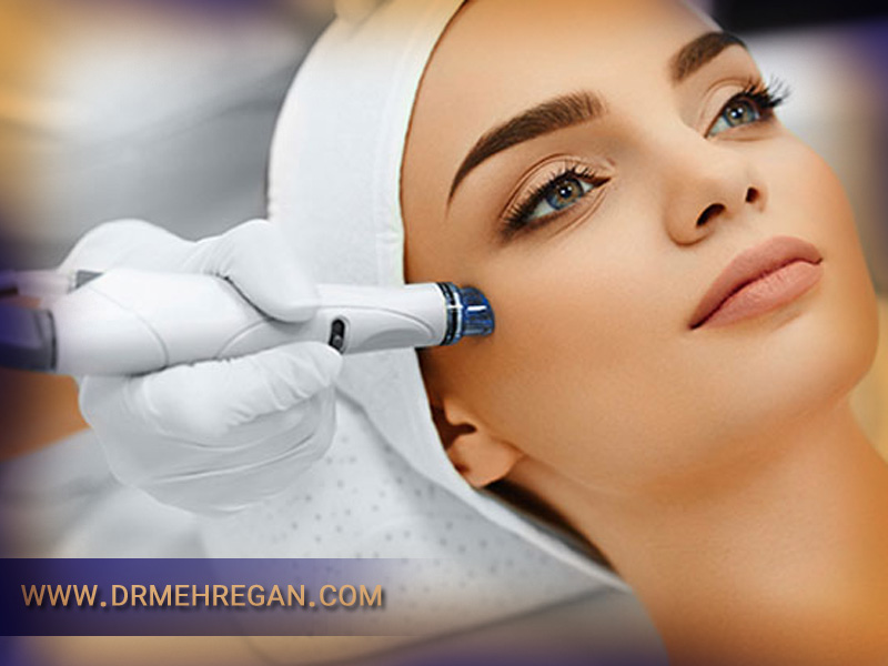میکرودرم