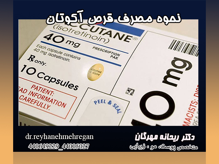 نحوه مصرف قرص آکوتان