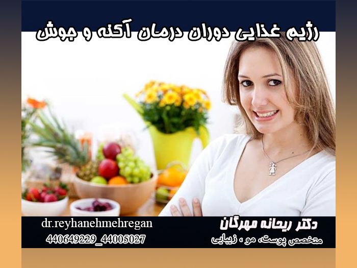 رژیم غذایی دوران درمان آکنه و جوش
