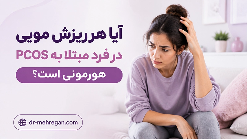 PCOS و ریزش مو