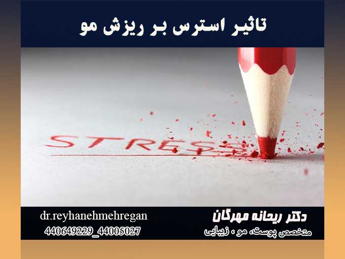 اضطراب و ریزش مو