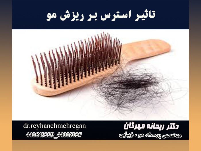 تاثیر استرس بر ریزش مو