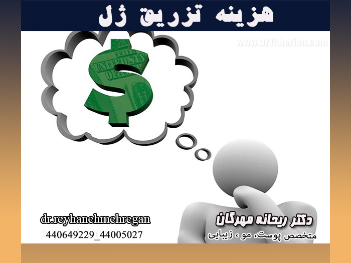 هزینه تزریق ژل