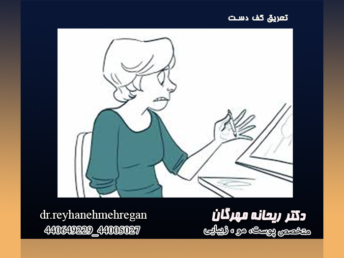 تعرق کف دست