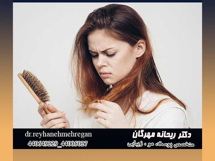 ریزش مو خانم های شیرده