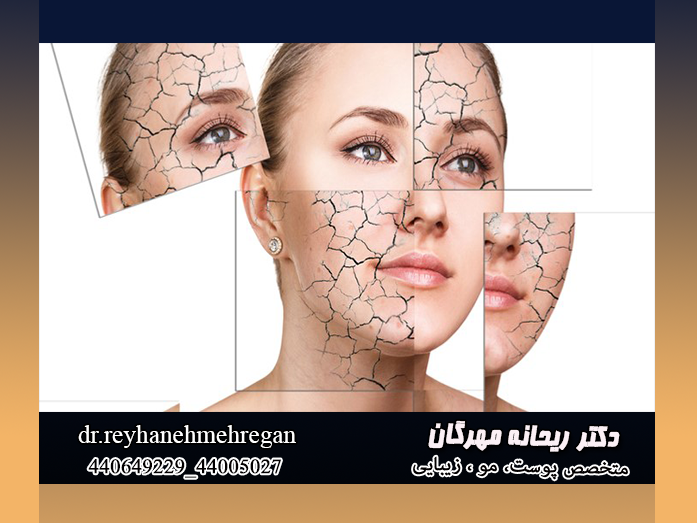 خشکی پوست