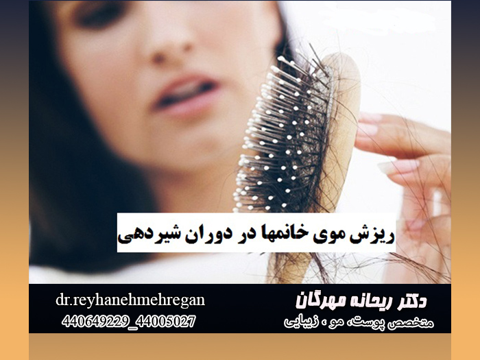 شیردهی و ریزش مو