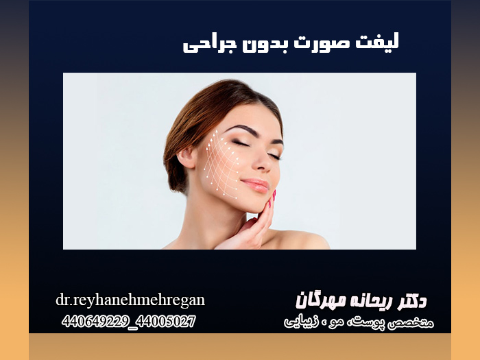 روش های مختلف لیفت صورت