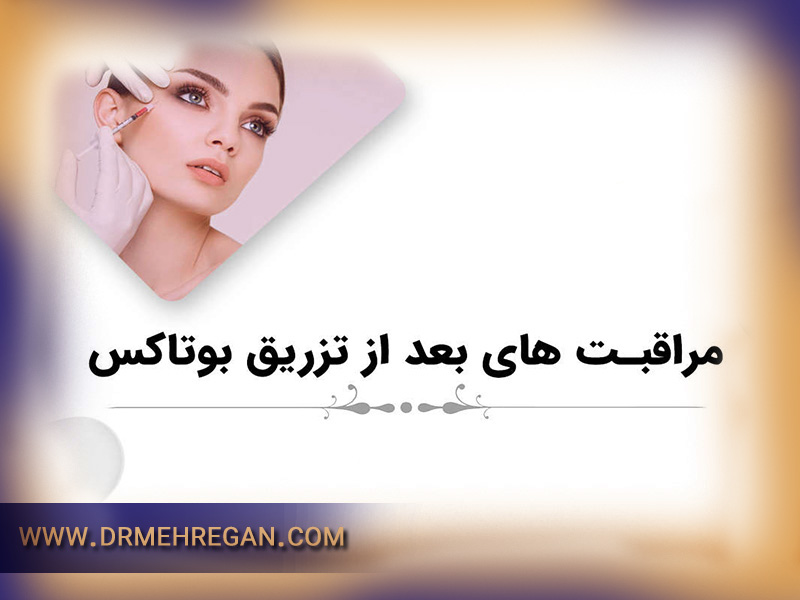 مراقبت های بعد از تزریق بوتاکس