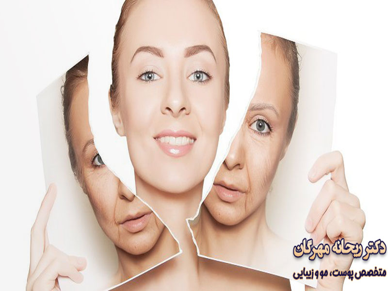 تزریق چربی