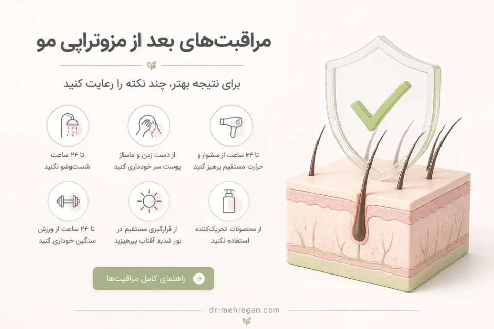 مراقبتهای بعد از مزوتراپی مو — مراقبت ملایم از پوست سر پس از مزوتراپی مو
