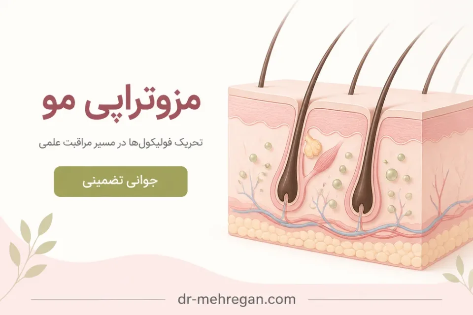 نمای توضیحی درباره مزایا و محدودیتهای مزوتراپی مو