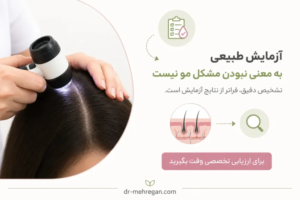 نمای توضیحی درباره آیا آزمایش طبیعی به معنی نبودن مشکل مو است